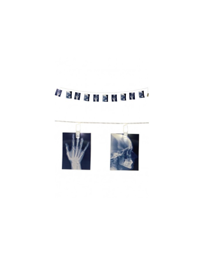 FILZA CON RADIOGRAFIE E LUCI  09142